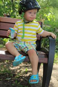 sindrome-down-estrabismo-infantil