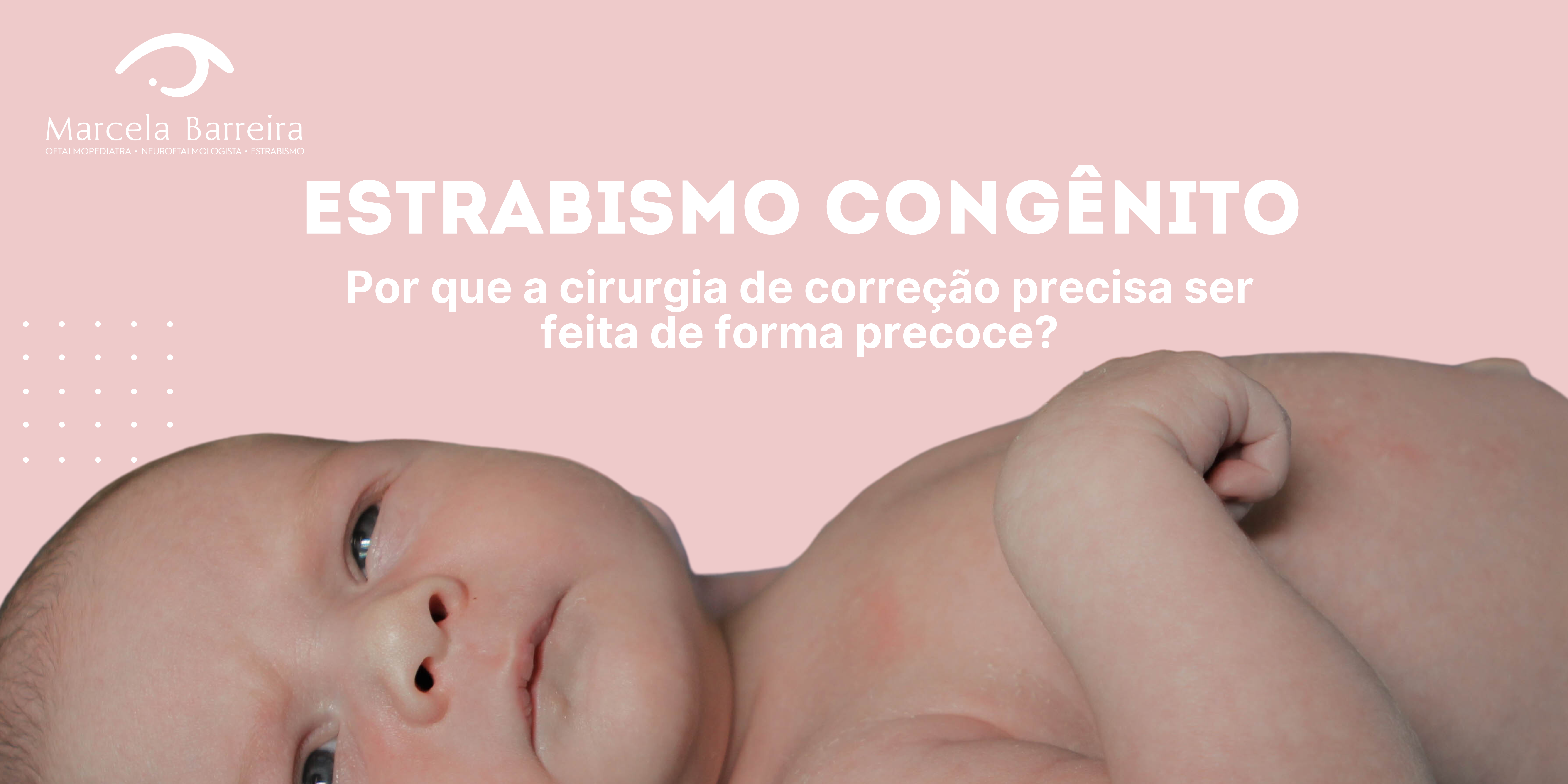estrabismo congênito